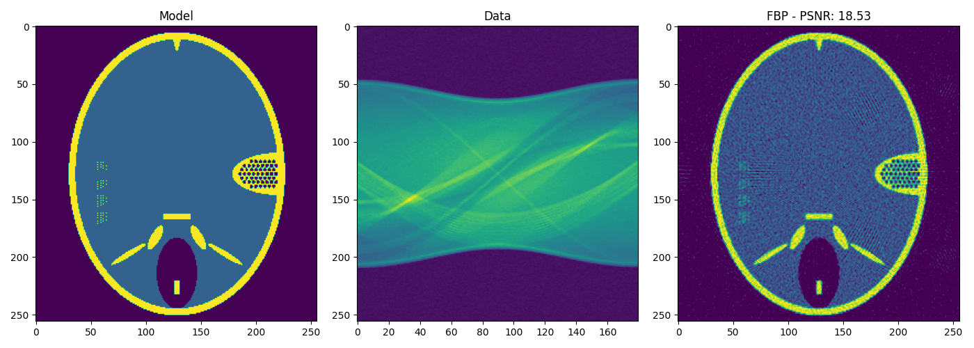 Model, Data, FBP - PSNR: 18.53