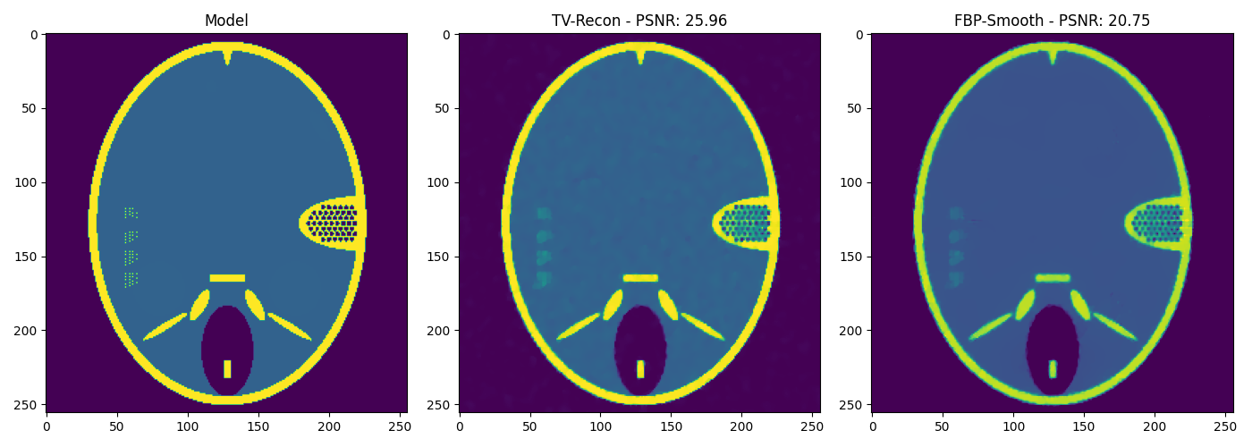 Model, TV-Recon - PSNR: 25.96, FBP-Smooth - PSNR: 20.75