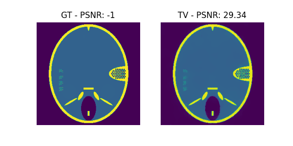 GT - PSNR: -1, TV - PSNR: 29.34