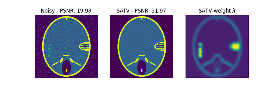 Noisy - PSNR: 19.98, SATV - PSNR: 31.97, SATV-weight $\lambda$